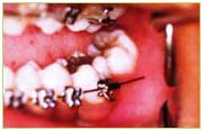Orthodontics11