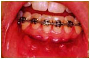 Orthodontics12